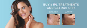 IPL Treatments Special